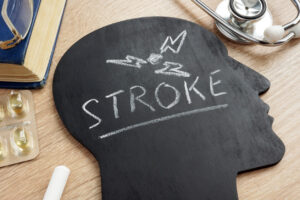 A Stroke Is a 'Brain Attack'